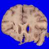 22B2 (Case 22) A.015