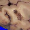 22B6B (Case 22) A.030