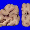22B7A (Case 22) A.031