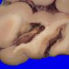 22B7B (Case 22) A.032