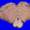 22B8 (Case 22) A.036