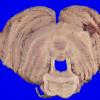 22B9A (Case 22) A.037