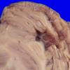 22B9B (Case 22) A.038