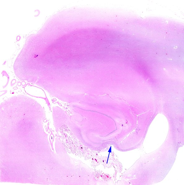 22C3A (Case 22) A3 W copy