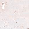 22C6B (Case 22) CD163 4X 3