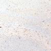 22C6D (Case 22) CD163 10X 2