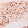 22C6E (Case 22) CD163 10X