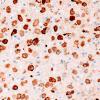 22C6G (Case 22) CD163 40X