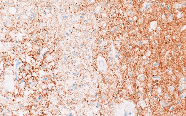 15C4 Mini-watershed (Case 15) A13 SYN 40X