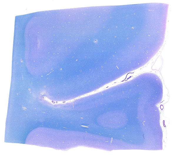 15F1 Mini-watershed (Case 15) A13 LFB-PAS WM