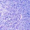 15F4 Mini-watershed (Case 15) A13 LFB-PAS 20X