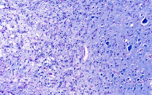 15F4 Mini-watershed (Case 15) A13 LFB-PAS 20X
