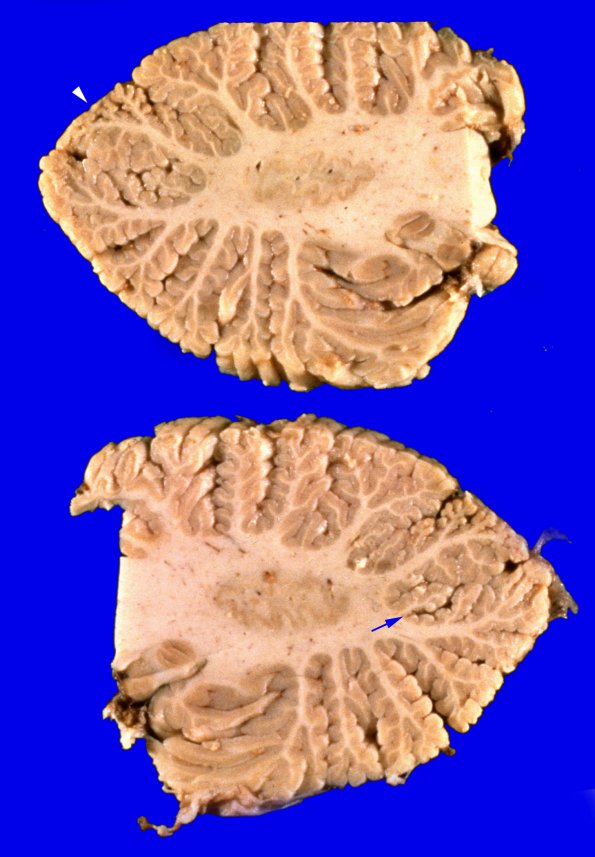 5A3 Nelson 13 (Case 5) 3 copy