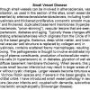 0A Small Vessel Disease - Text