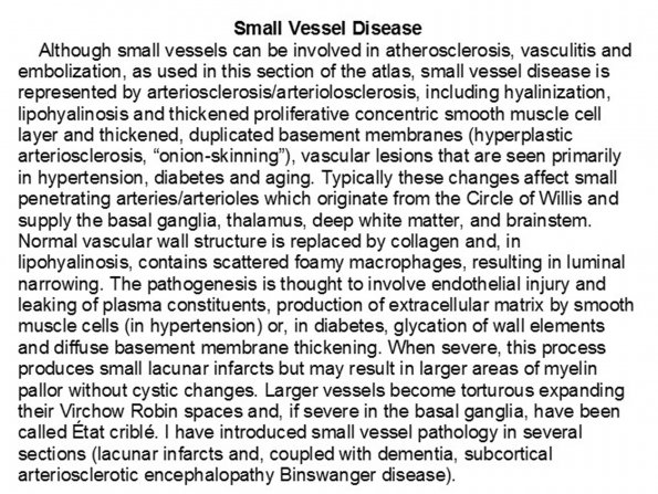 0A Small Vessel Disease - Text