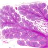 9D1 Infarcts, multiple, HT, dementia (Case 9) N20 H&E whole mount