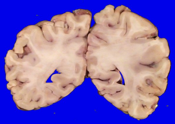 1A2 TTP (Case 1) 1_4