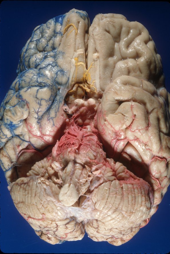 1A1 Vasculature, CNS, Normal, Injected vessels 1