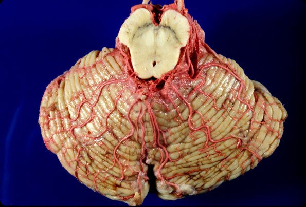 1A10 Vasculature, CNS, Normal, Injected vessels A4