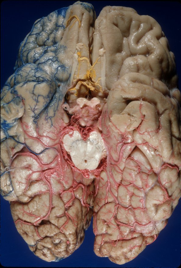 1A2 Vasculature, CNS, Normal, Injected vessels 2
