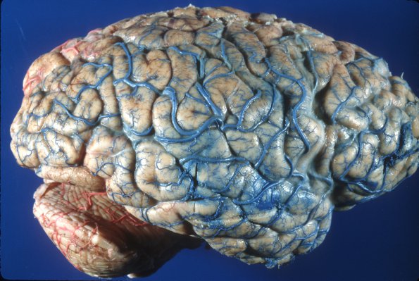 1A4 Vasculature, CNS, Normal, Injected vessels 4