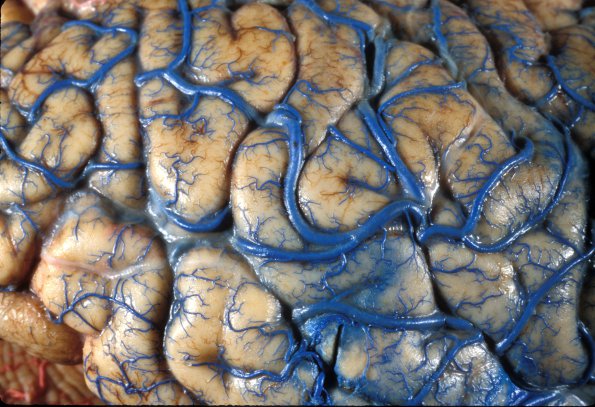 1A5 Vasculature, CNS, Normal, Injected vessels 9