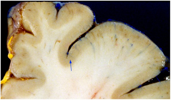 1A7 Vasculature, CNS, Normal, Injected vessels A9 copy