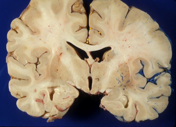 1A8 Vasculature, CNS, Normal, Injected vessels 8