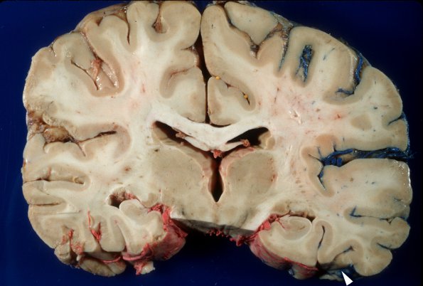 1A9 Vasculature, CNS, Normal, Injected vessels 7 copy