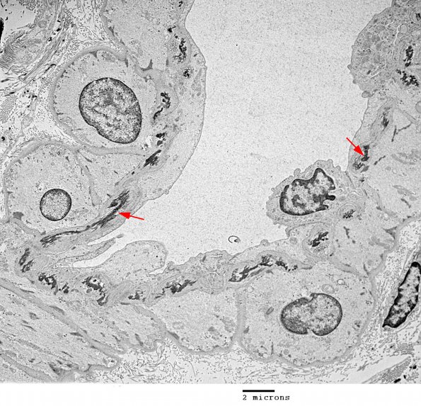 1A1 Venule with Elastic, muscle (Case 1) 015 - Copy copy