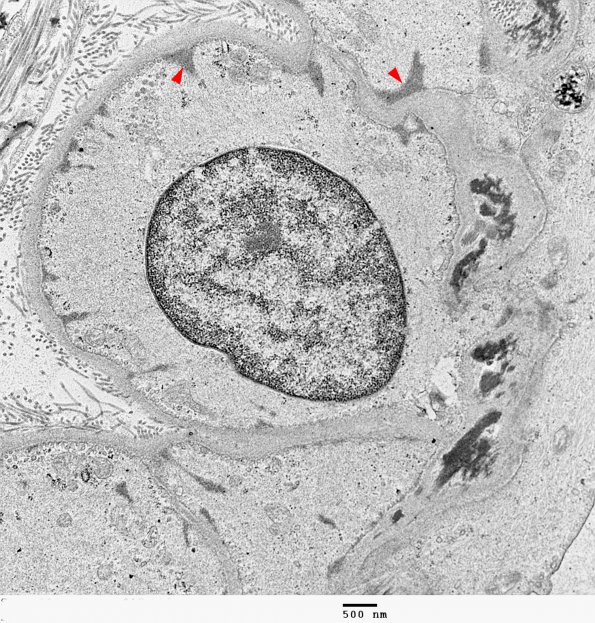 1A3 Venule with Elastic, muscle (Case 1) 017 - Copy copy