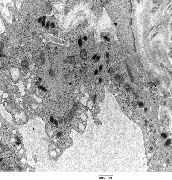 4A2 Venule Endothelium, normal, Weibel-Palade Body (Case 4) Skin_046 - Copy