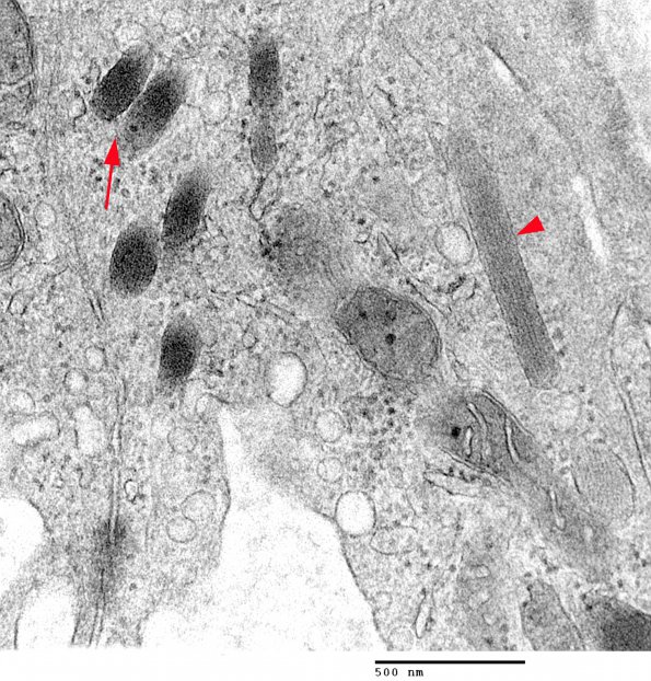 4A3 Venule Endothelium, normal, Weibel-Palade Body (S09-29212) Skin_048 - Copy copy