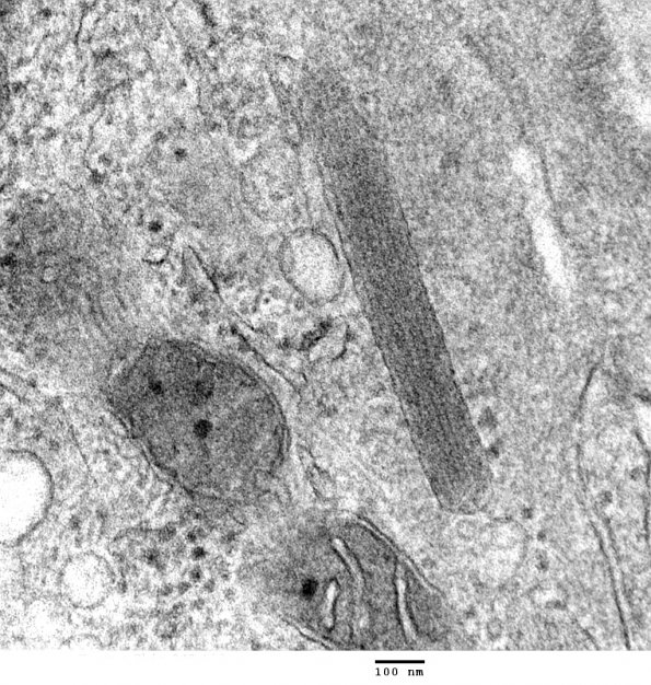 4A4 Venule Endothelium, normal, Weibel-Palade Body (Case 4) Skin_049 - Copy