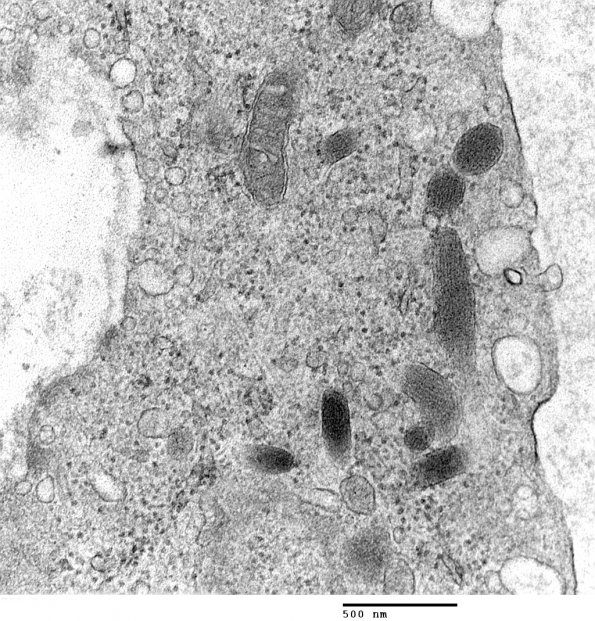 4A5 Venule Endothelium, normal, Weibel-Palade Body (Case 4) Skin_052 - Copy