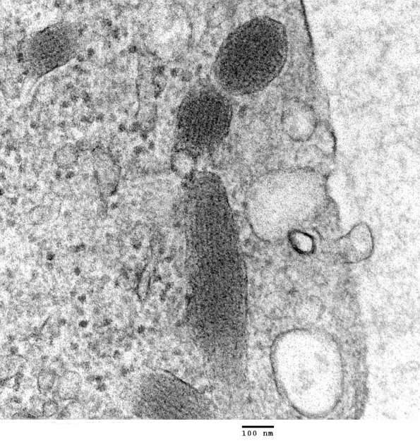 4A6 Venule Endothelium, normal, Weibel-Palade Body (Case 4) Skin_055 - Copy