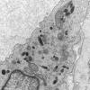 5A2 Venule Endothelium, normal (Case 5) EM 024 - Copy