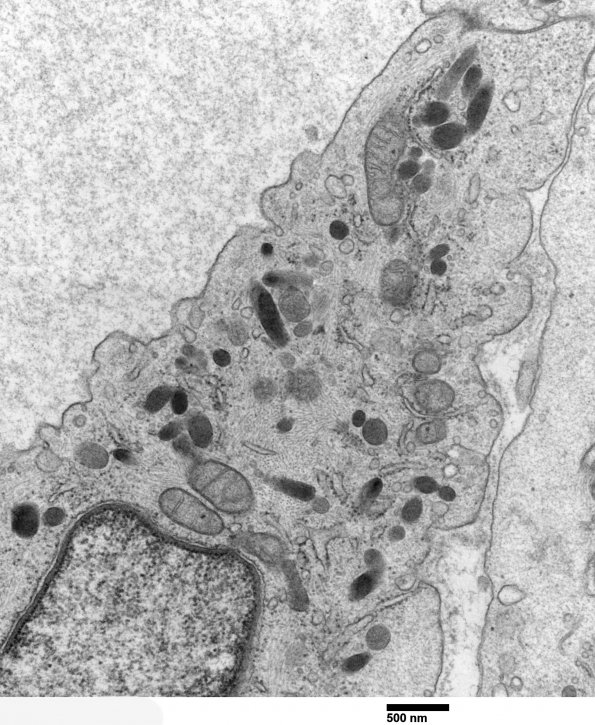 5A2 Venule Endothelium, normal (Case 5) EM 024 - Copy