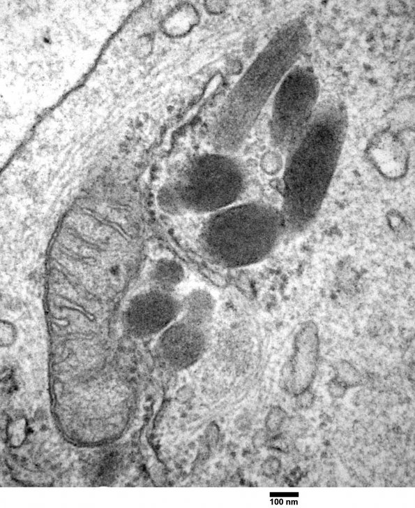 5A3 Venule Endothelium, normal (Case 5) EM 028 - Copy