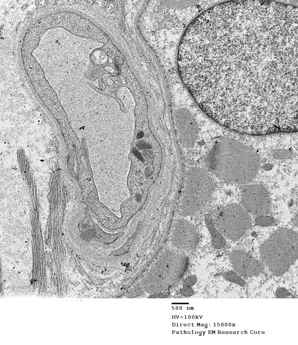 7A1 (Case 7) EM015 muscle - Copy