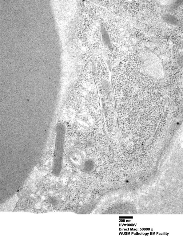 8A4 (Case 8) EM020 muscle - Copy
