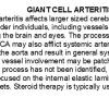 0A Giant Cell Arteritis - Text