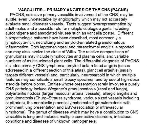 0A Vasculitis (PACNS) - Text