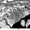 15D2 Vasculitis, SLE tubuloreticular inclusions (Case 15) EM 047 - Copy